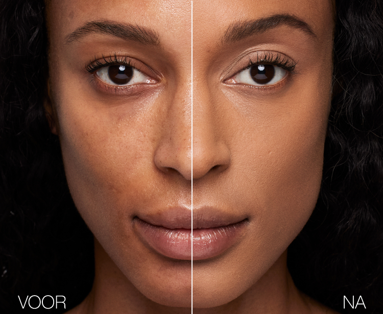 VERZORG JE HUID GOED